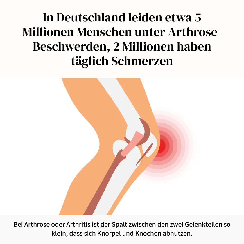 Glucosamin, Chondroitin, Hyaluronsäure und MSM